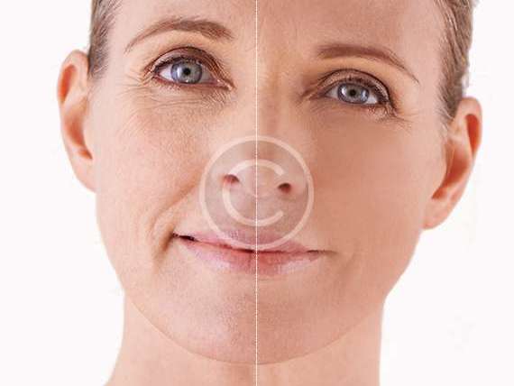 Screening & treatment of cancer